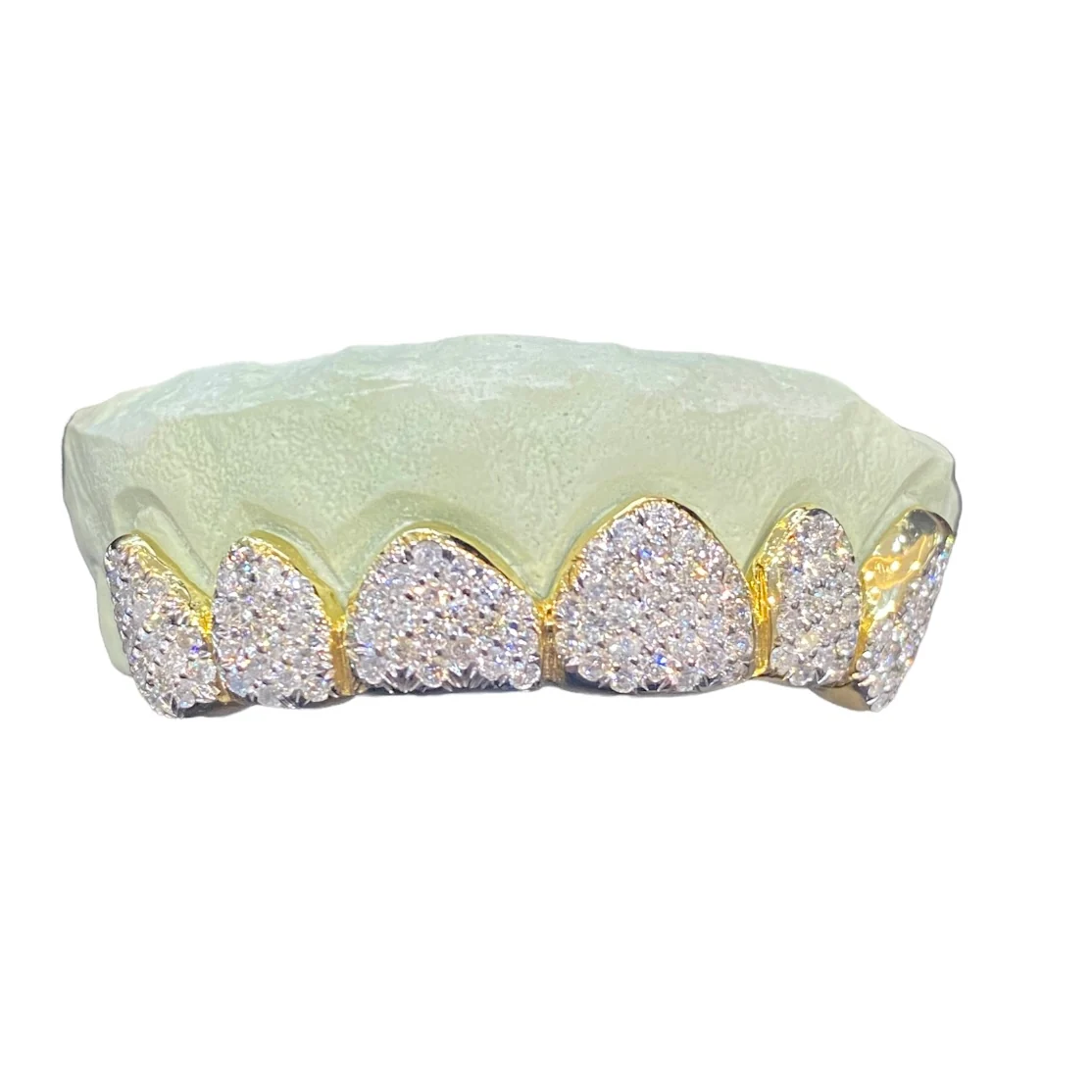 Custom Honeycomb Diamond Grillz